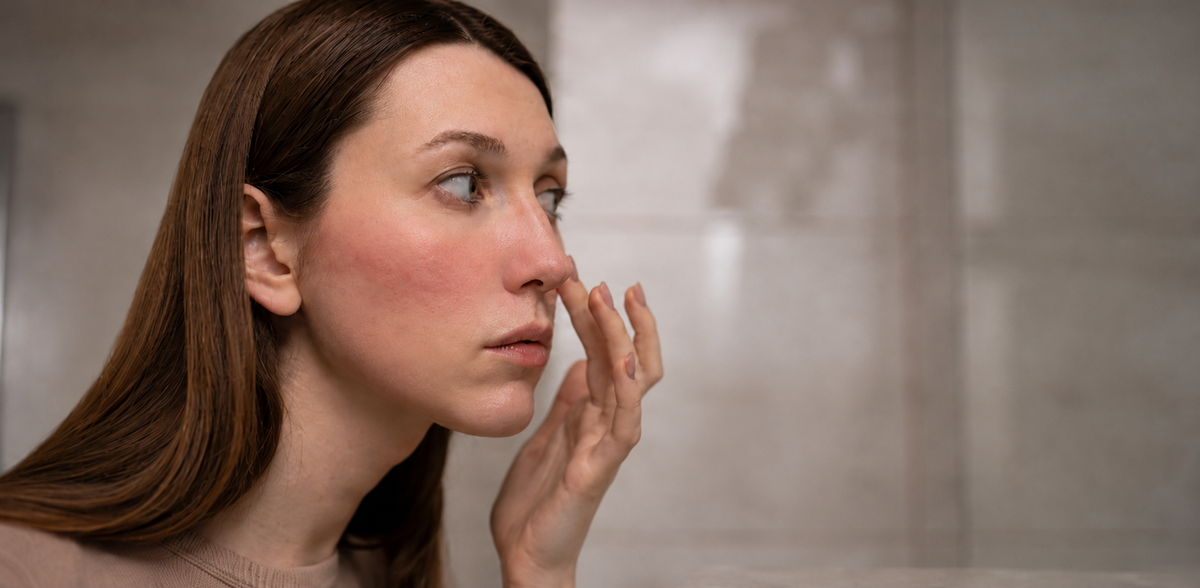 Woman with visible facial redness applying Omiana Redness Concealer Cream